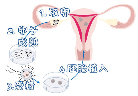 槿棠生殖中心环境